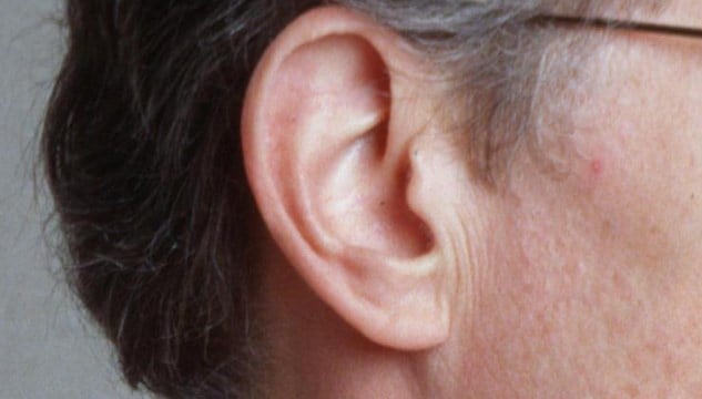 Research Finds Important Protein Associated With Hearing - - CBS19 News